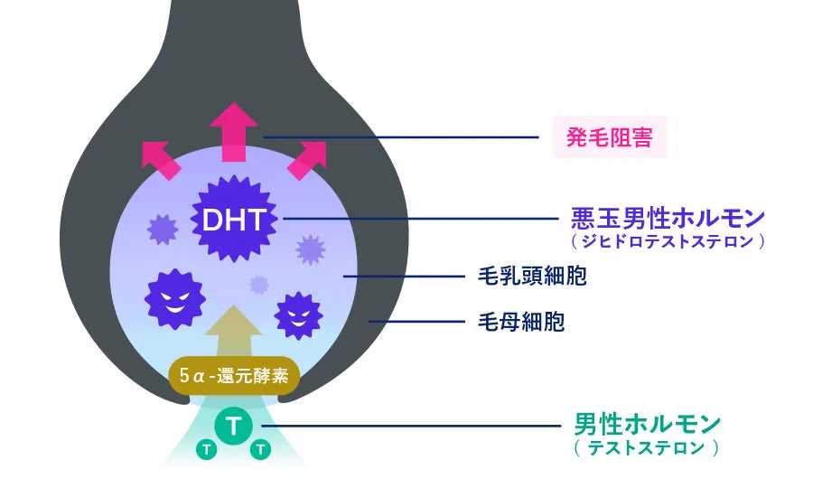 男性型脱毛症は予防できるのか?