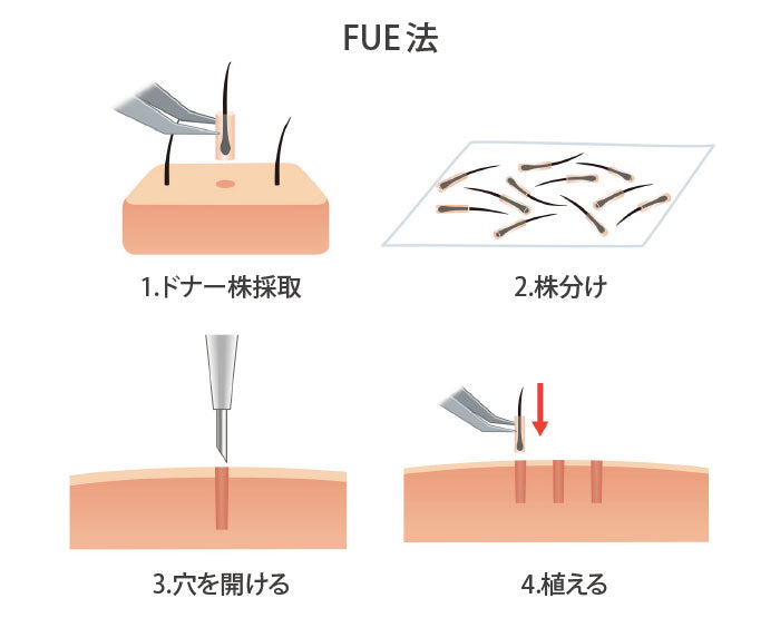 Torukosyokumou