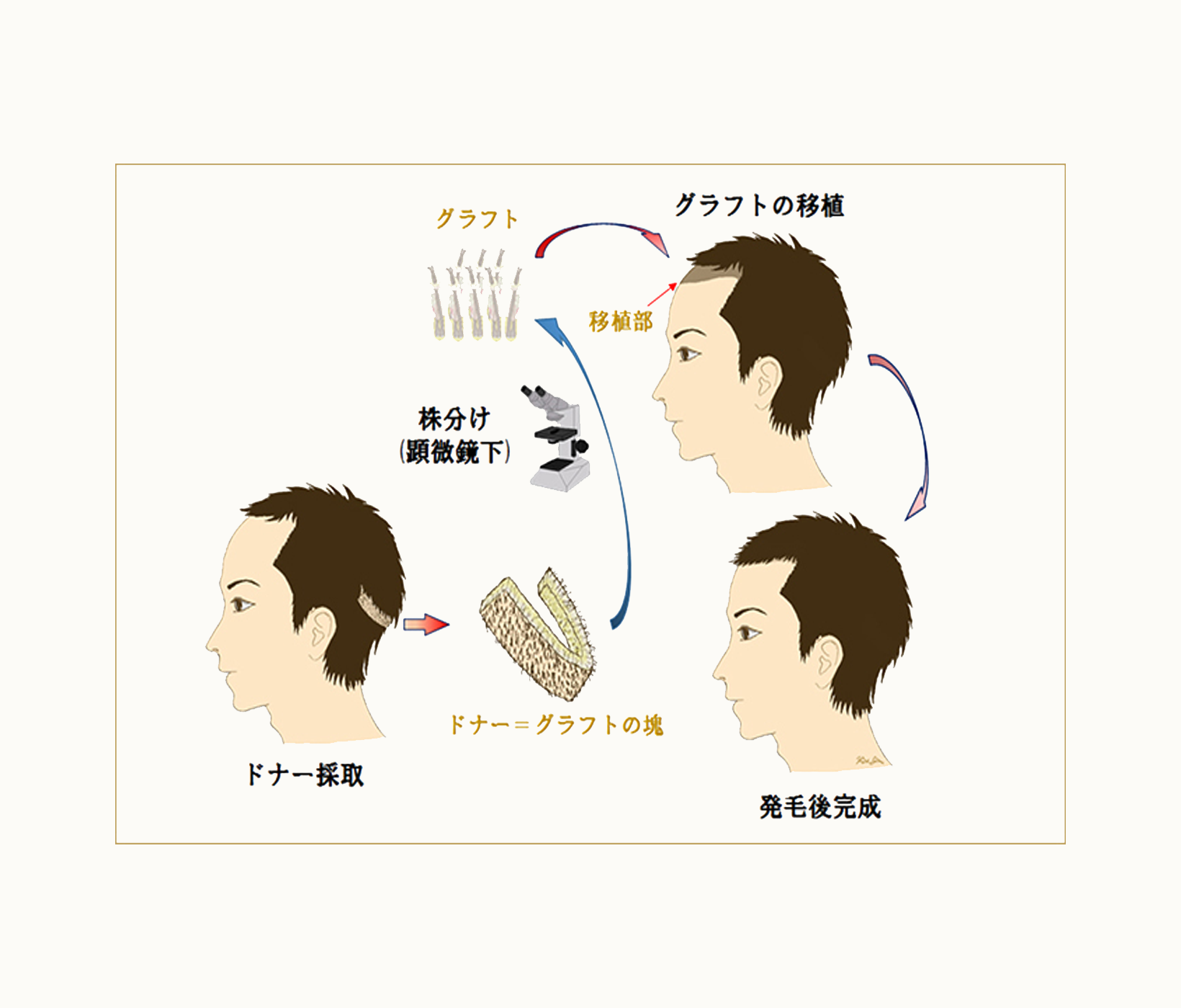 Torukosyokumou